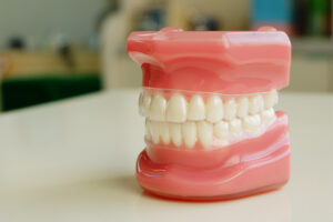 マウスピース型矯正装置（シュアスマイル）